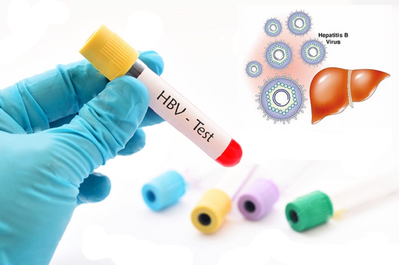Hình 1: Virus HBV là nguyên nhân gây bệnh viêm gan B.